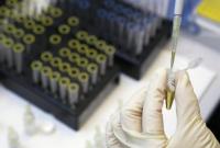 Ученые рассказали о пользе употребления углеводов для долголетия