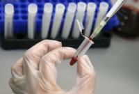В 2018 году на острый вирусный гепатит А заболели более 2000 человек