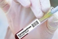 Коронавирус. Заболело более 380 000 человек: последние данные